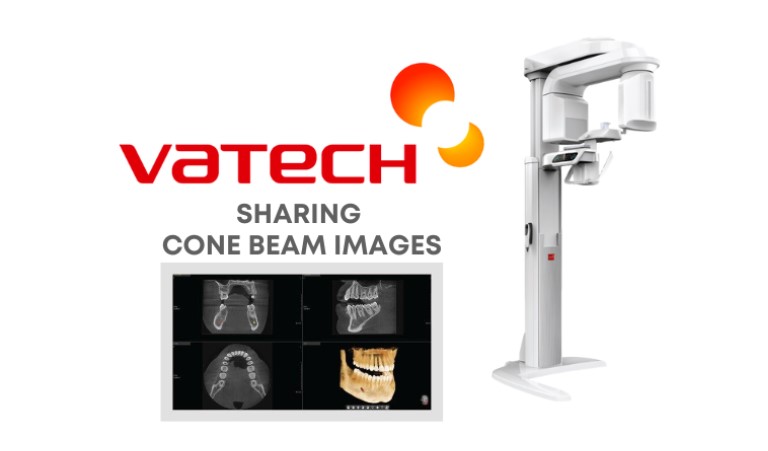 Vatech CBCT Scanner
