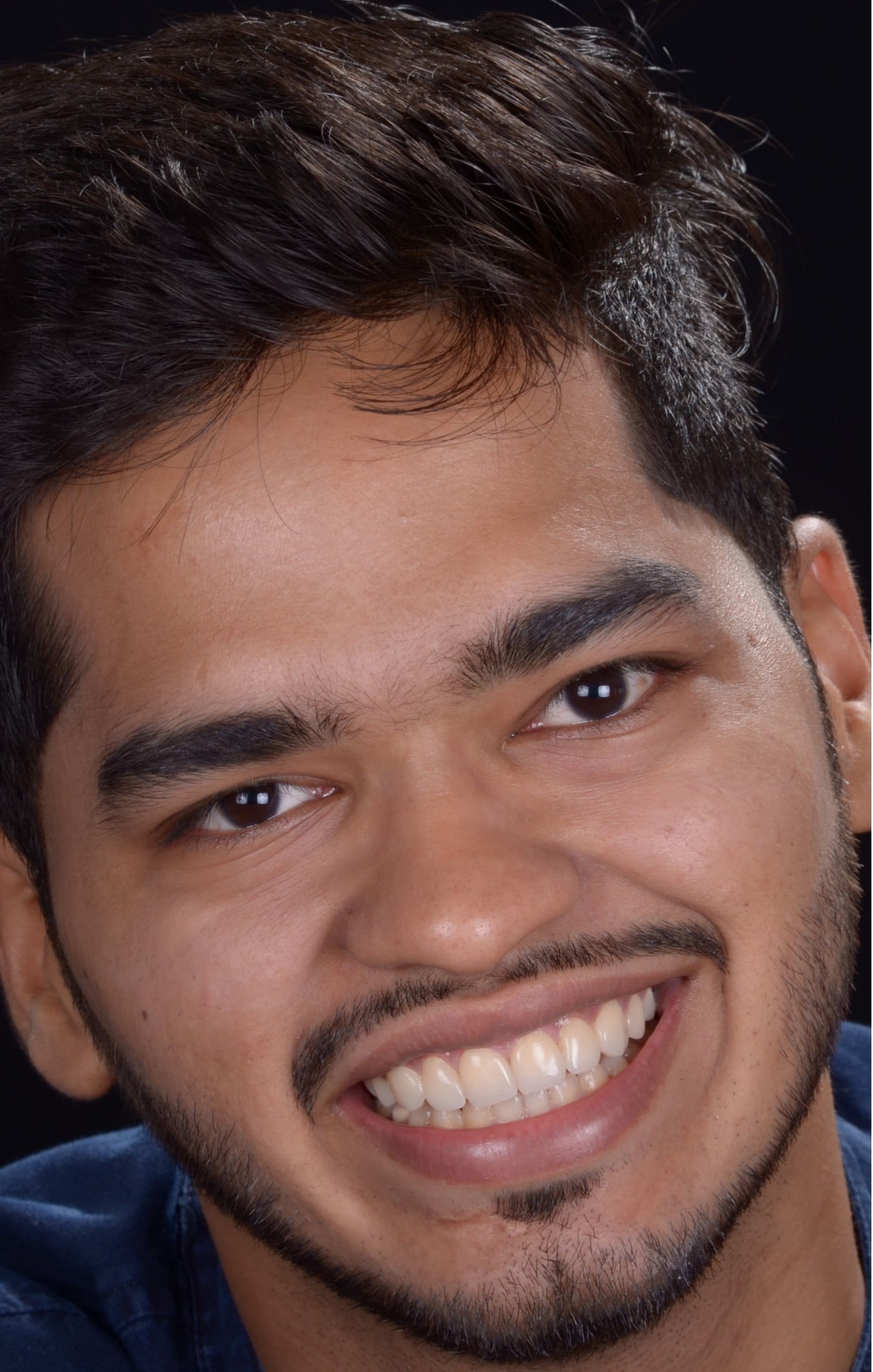 Armaash after smile makeover