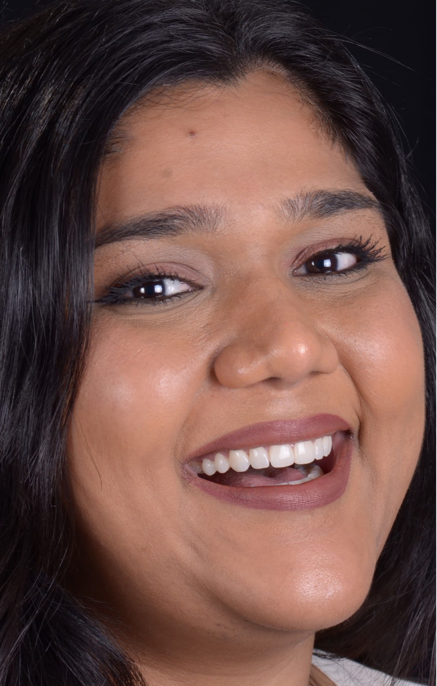 Jagruti after dental treatment