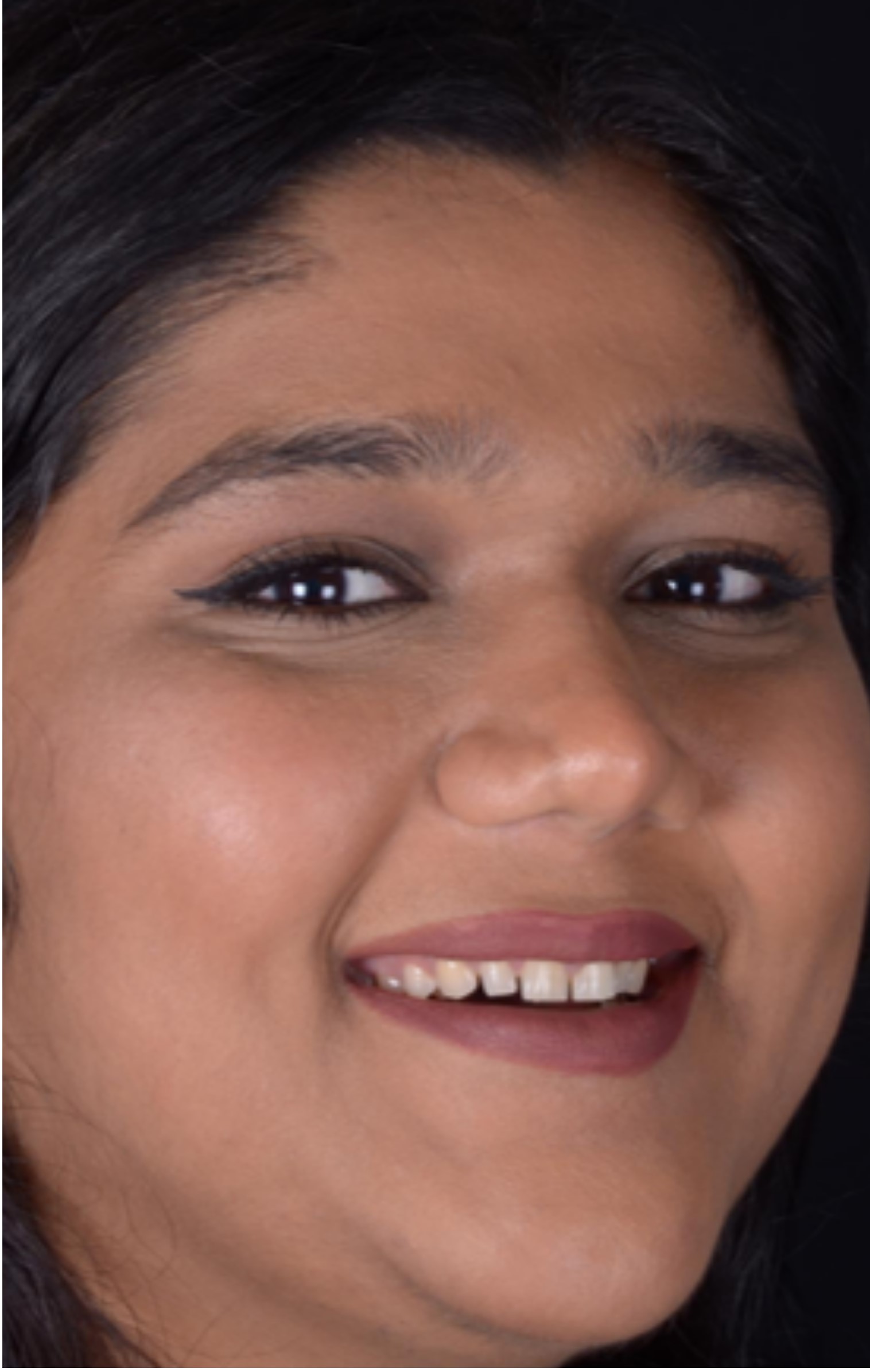 Jagruti before dental treatment