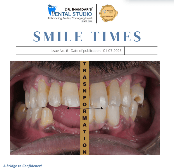 A bridge to Confidence!