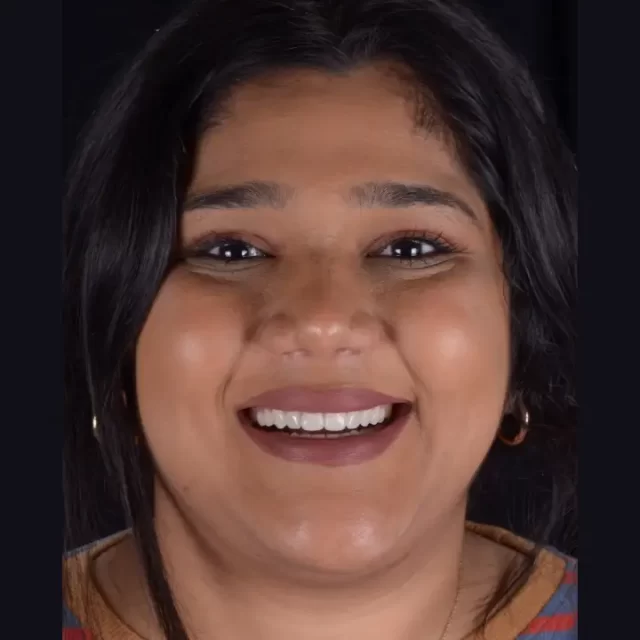 Digital Smile Design