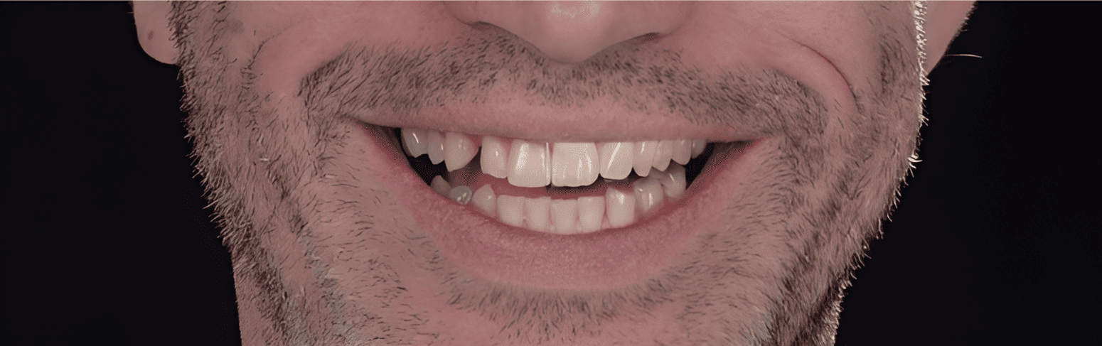 Facially Driven Smile Design