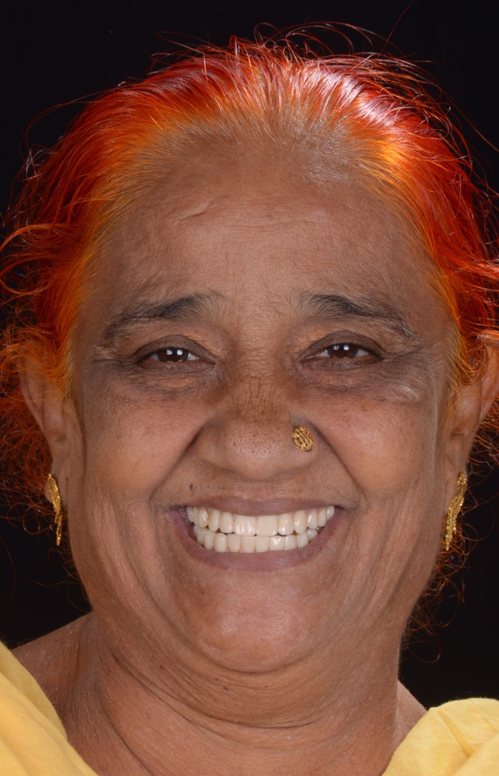 Special Needs Dentistry