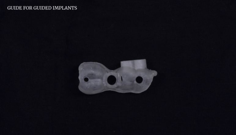 Transparent surgical guide used for guided dental implant