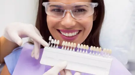 How Long Do Veneers Last? Longevity, Care & Replacement Options