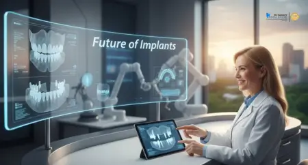 All-on-Four Implants: The Future of Full Mouth Rehabilitation