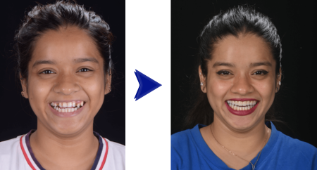 From Pain to Confidence: A Clinician’s Perspective on a Life-Changing Smile Journey