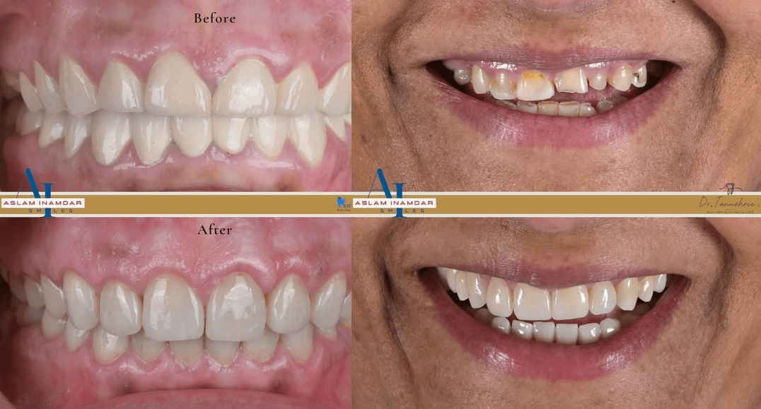 How Severe Dental Problems Can Be Treated in 48 Hours
