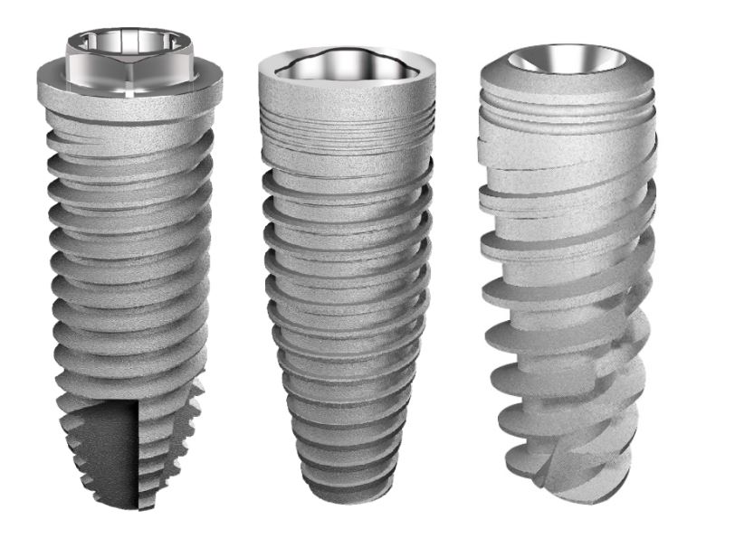 Titanium dental implant
