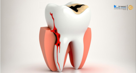 Sugar Isn’t the Only Enemy: Hidden Foods That Are Ruining Your Teeth