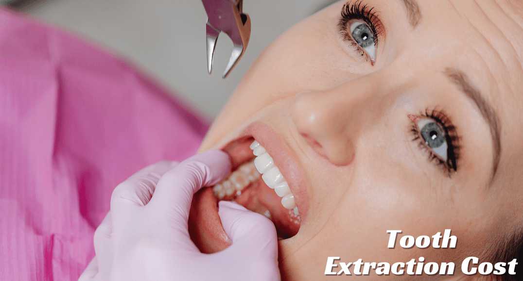Tooth Extraction Cost in Mumbai