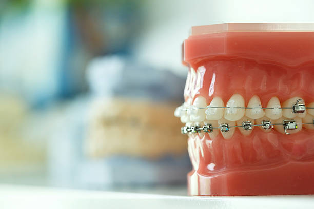 A model of a dental brace