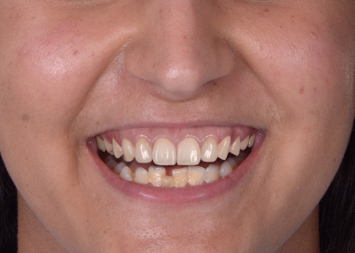 Smile before treatment