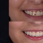 Dental Studio Blog 2 banner copy