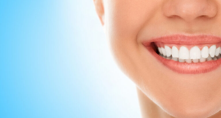 Cover image Teeth WHitening